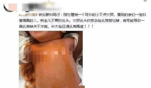 鼻梁|新生儿出生7天哭闹不停,宝妈掀开衣服一看,是婆婆动了“手脚”