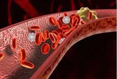  长期服用阿司匹林会让血管又脆又薄，容易出血？医生告诉你真相