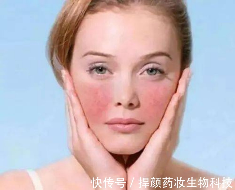 敏感肌|敏感肌肤的妹子注意了!呵护脸蛋这样做才正确!