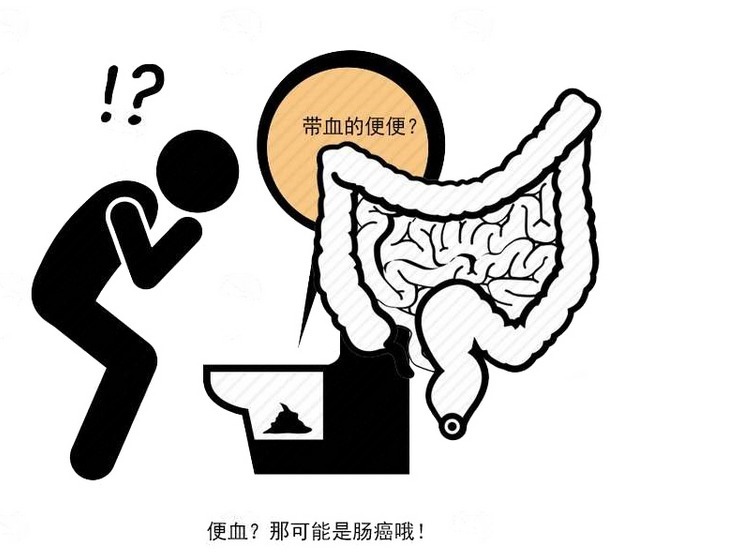 直肠癌|排便后不妨看看,出现便血,这样分析是痔疮还是直肠癌信号!