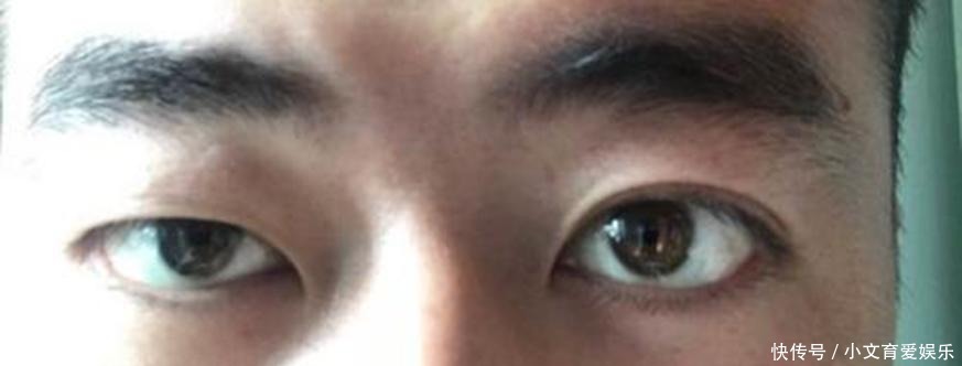 重瞳、雌雄眼、鹰视狼顾, 历史上这些面生异相之人