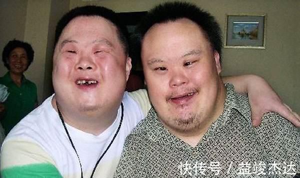 21三体综合征|高龄孕妇不听劝阻,一心生二胎,艰难生子后,家人感慨不如不生