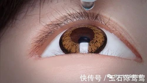 患病率|干燥综合征的鉴别诊断