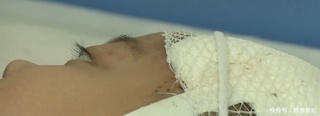 胎记|4岁女童头上的胎记，一查竟是血管瘤，医生给出了答案