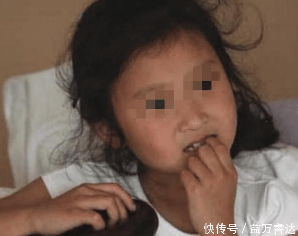 心理|从小“咬指甲”的孩子,长大后会怎样?专家坦言:逃不开2种结局