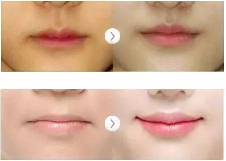 年纪轻轻就失去少女感，还能补救吗？