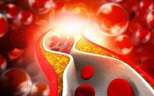 不良习惯|经常喝酒的人，易导致血压飙升！高血压对身体的损伤，莫轻视