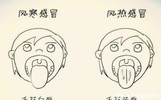 耳鳴|手腕有個“坑”，耳鳴見它就跑春季常用