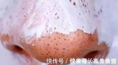 鼻子|女生鼻子上“黑头泛滥”,坚持这3个好习惯,鼻子会越来越白净