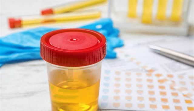 上起床后出现5种情况,或在警告你肝脏早已“伤痕累累”