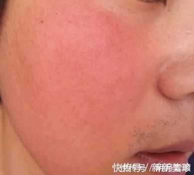 患有高血压|高血压会引起身体出现这些表现, 当你发现时别忽视!