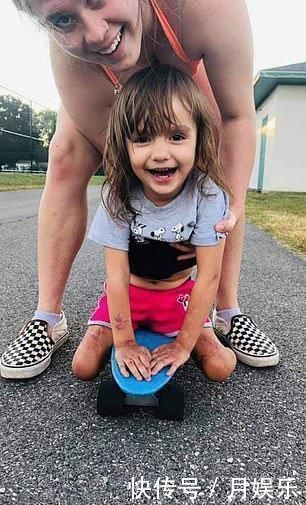 莱利|2岁女孩总发烧家人以为是感冒,送进医院却被立即截去双腿