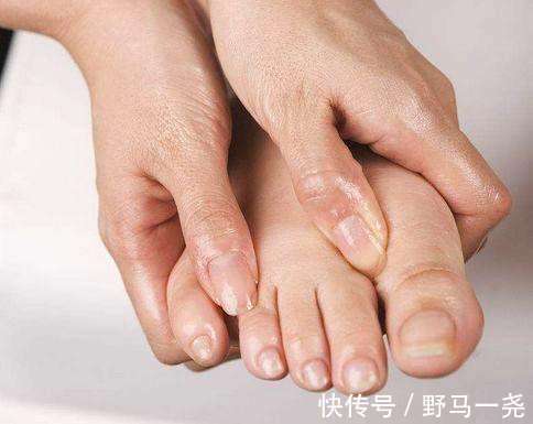 灼热感|皮肤出现3个信号,警惕糖尿病“恶化”!做好2点,远离并发症