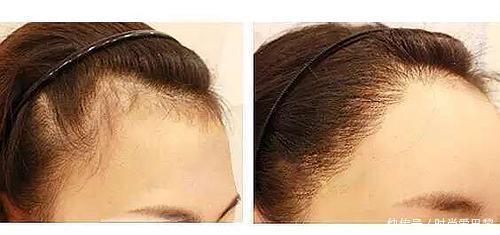 双眼皮|美女是从小养成的,娃脸上的六条线,看看你家孩子有没有