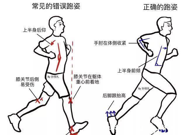 骨关节炎|跑步伤膝盖?医生直言:这2种运动真伤膝盖,45岁后,尽量少做