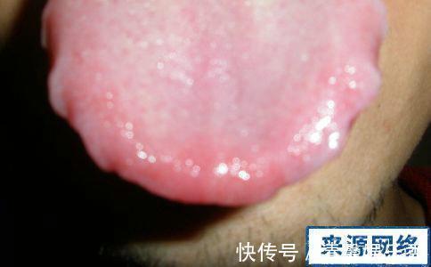 祛湿|湿气的“七寸”在哪里?你抓对了吗?湿重,少做3事,贵在坚持