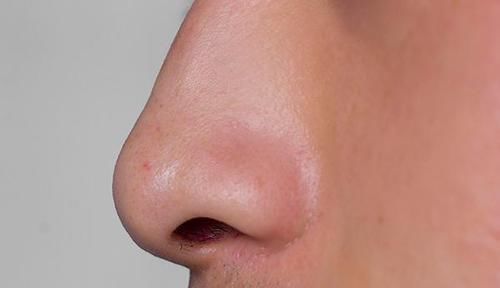 鼻毛太长,冒出鼻孔,要拔掉或剪掉吗为什么鼻毛会冒出鼻孔