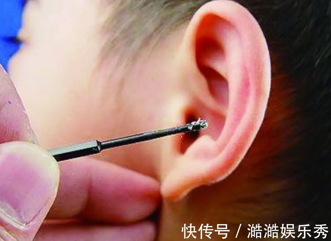 听力|娃耳朵进虫子,妈妈果断地处理方式救了孩子的听力,连医生都夸赞