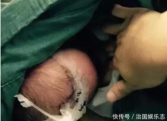 手术室|一个多月大宝宝在手术室哭闹不停!护士竟将宝宝抱起来后掀开衣服