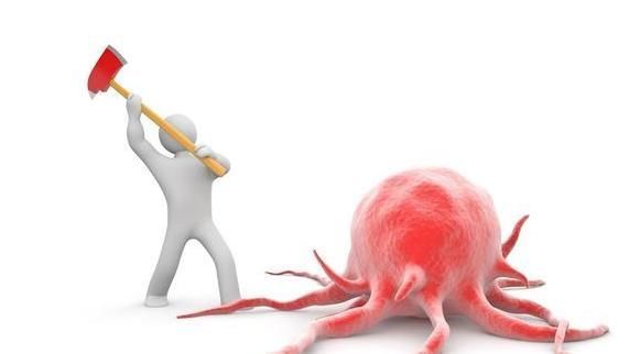 癌基因|肿瘤的发展,分为5个阶段,到了晚期基本就“无力回天”!