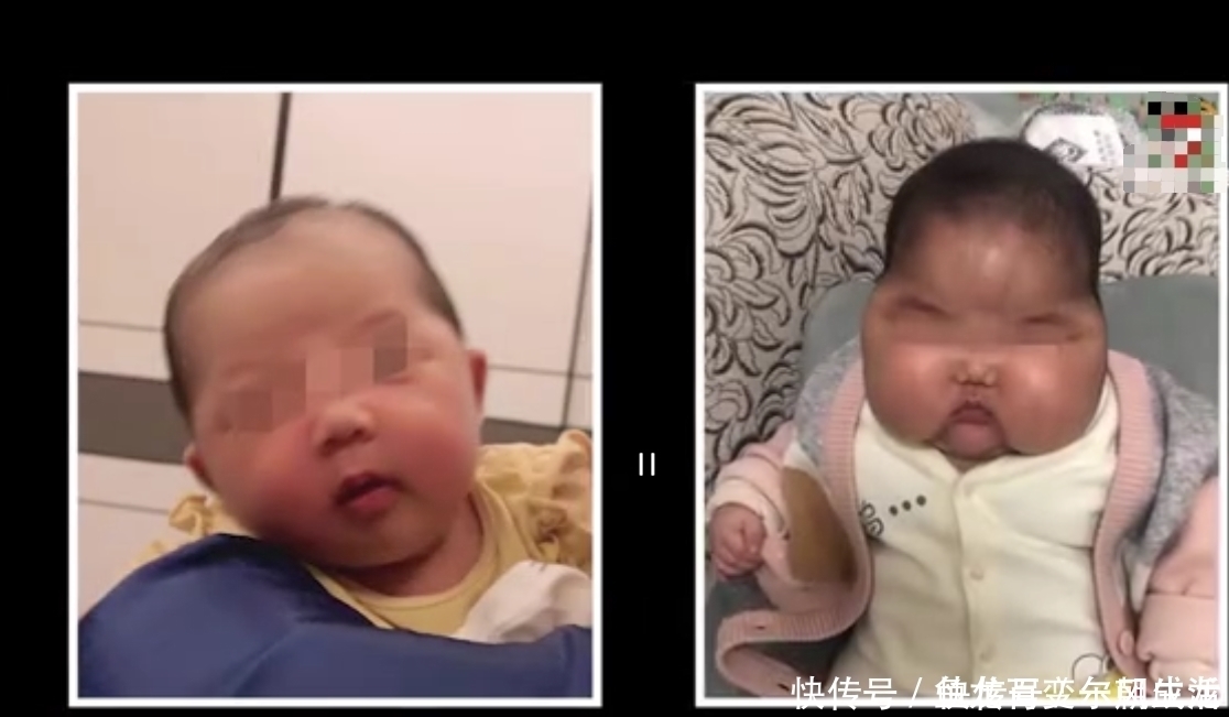 汗毛|“大头娃娃”事件卷土重来：这款婴儿霜激素超标，请家长赶快自查