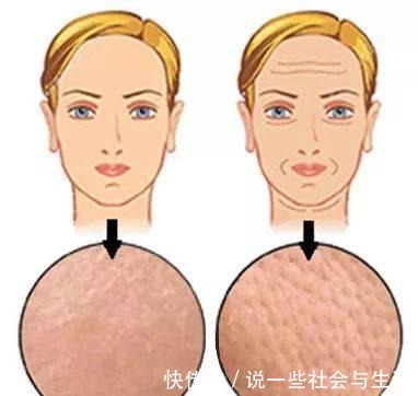 黑头 毛孔粗大难改善4种毛孔问题对症下药|医美科普!