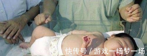龙凤胎|产妇生下龙凤胎,哥哥吃奶粉,妹妹吃母乳,6个月后差距太大