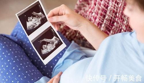 怀孕期间|新生儿有黄疸,孕期这个行为是“罪魁祸首”,有身孕的妈妈要控制