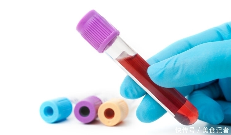 看血型就可以预测癌症？如果你是这两种血型，那就要留意了