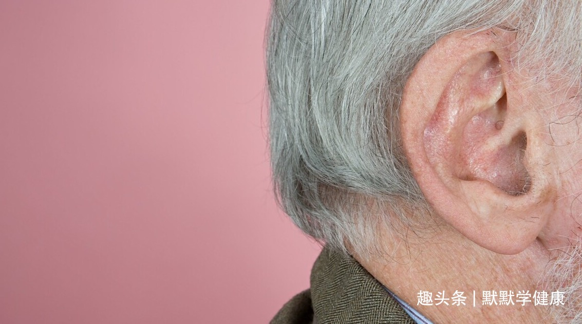 血热|白发多显人老两味药去白发，四百年前的老方子，不该被埋没！