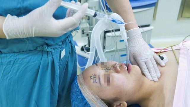 用管|插管深浅，一摸便知—触摸套囊法用于判断插管深度