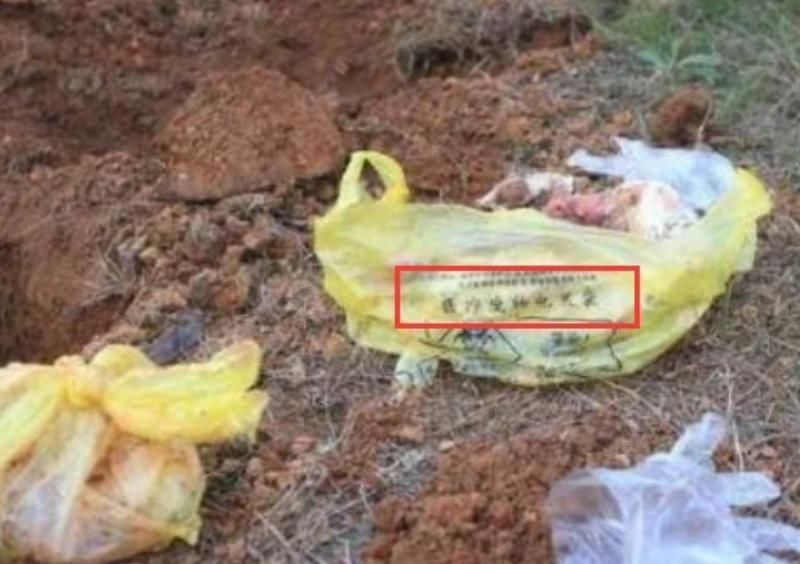 沙子|人工拿掉的“胎儿”去哪了?看到这几个处理方式,眼里仿佛进了沙子