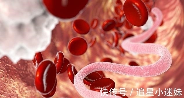 食材|一口能吃出几千条“寄生虫”?有3种食材可能是寄生虫的“最爱”