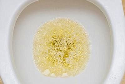 现象|出现“蛋白尿”一定是生病了吗？3类情况属于正常现象，不用担心