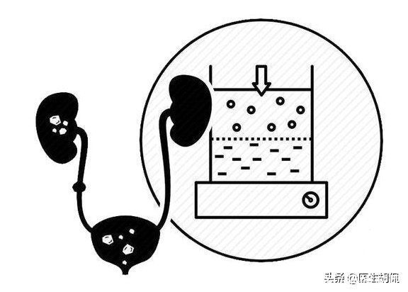 肾脏功能|预防尿毒症，这4类高发人群要多留个心眼，避免被“盯上”