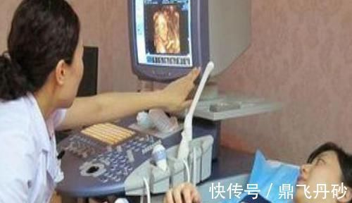 子宫|怀孕后孕妇的内脏被挤成啥样?看了这张图就明白了,真的很心疼