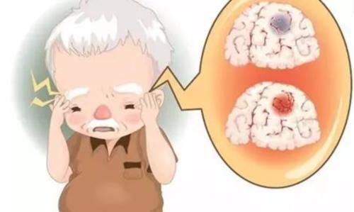 交感神经|高血压最“致命”的3个时刻,很多人不知道,为了家人健康早了解