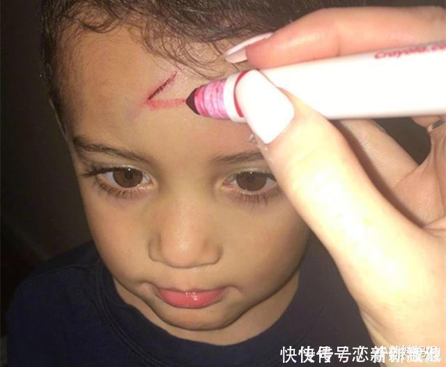 男孩不小心磕破了额头,宝妈灵机一动,让娃变成了“哈利波特”