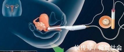 建档|怀孕后孕检口诀1建,1筛,2查,3超少不了,宝宝健康怀里抱