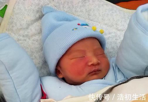 心理健康|孕期这三个行为,容易让胎记找上宝宝,准妈妈需尽量避开