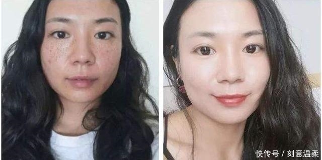 红霉素软膏加它涂抹脸部,不出15天淡斑又美白,赶紧去备上一支