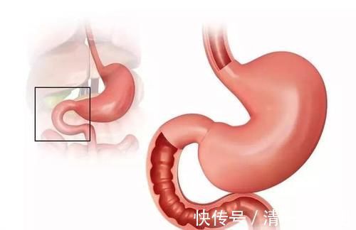 营养成分|胃不好三分治七分养!养胃护胃:常吃3黄,常喝2粥,做好1事