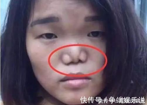 初中女生|初中女生别嫌鼻子不好看,3招变成好看“艺术鼻”,校花嫉妒使我丑陋