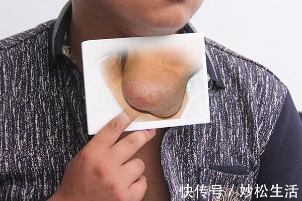 好处|几块钱一瓶的维生素E,能解决啥问题?医生:好处不少,但别乱用