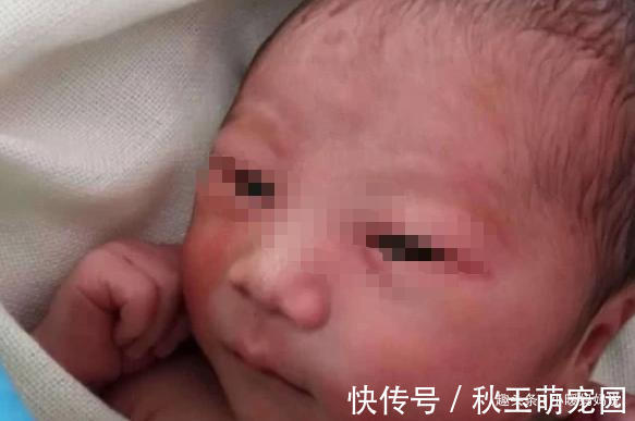 医生|孕妈预产期过了3周才去医院,医生剖腹后差点熏晕,无知差点害人