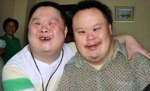 唐氏综合征|45岁怀上男孩,羊水穿刺为阳性仍坚持生,最后全家都傻眼了