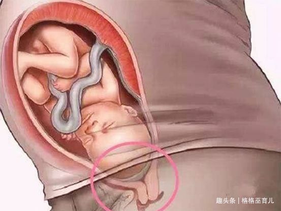 胎儿|胎儿入盆是什么感觉？产后怎样坐月子？
