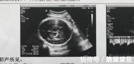 胸部|孕妈有这3个“信号”,可能是小宝贝在告诉妈妈自己的“性别”!