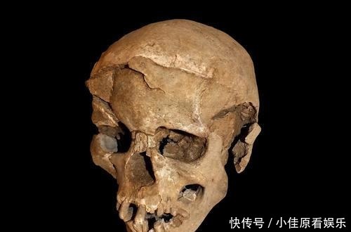 些史前人类|史前人类骸骨头上有圆孔?《黄帝内经》中有记载,打脸西方学者