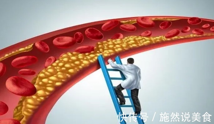 高密度脂蛋白|为何每天坚持运动锻炼,血脂就是降不下来现在知道还不算晚